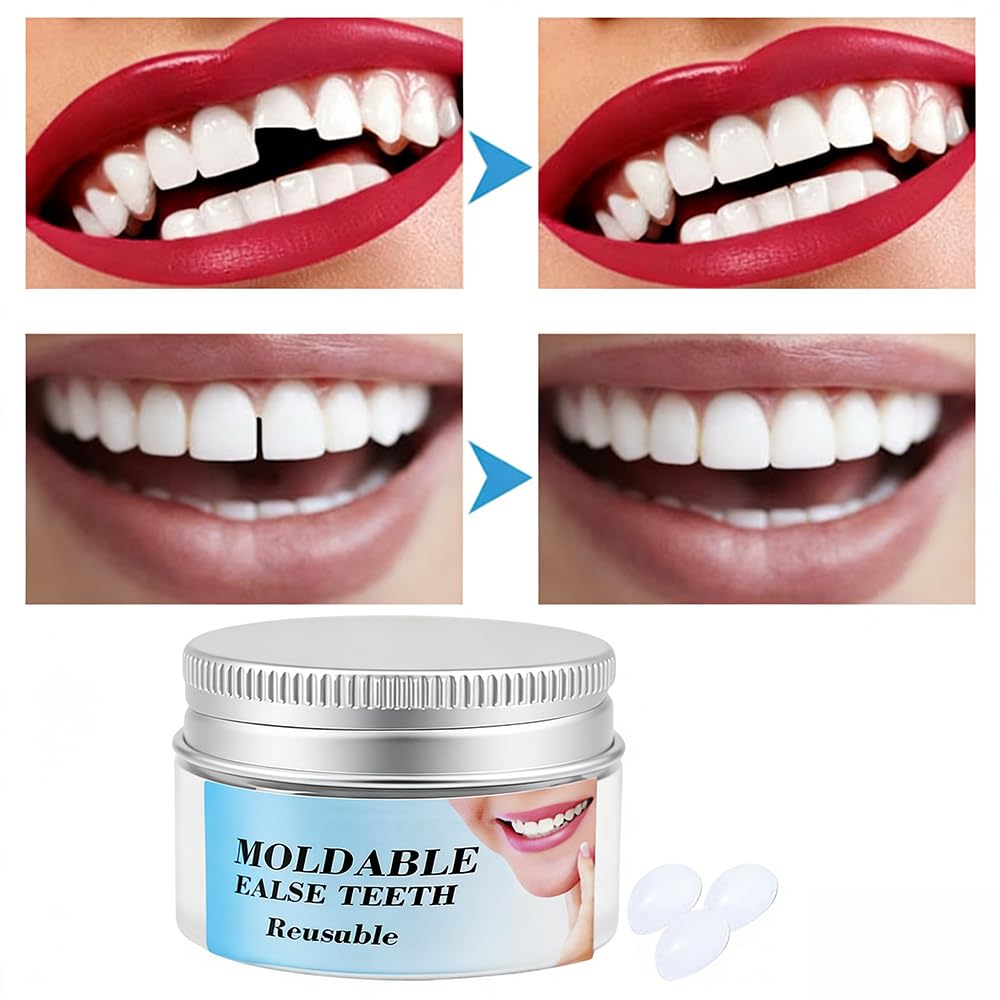 Kit de Réparation Dentaire, Pâte à Moulage Temporaire, Combleur d'Interdents DIY, Gel Granuleux pour Prothèses Dentaires et Petites Réparations