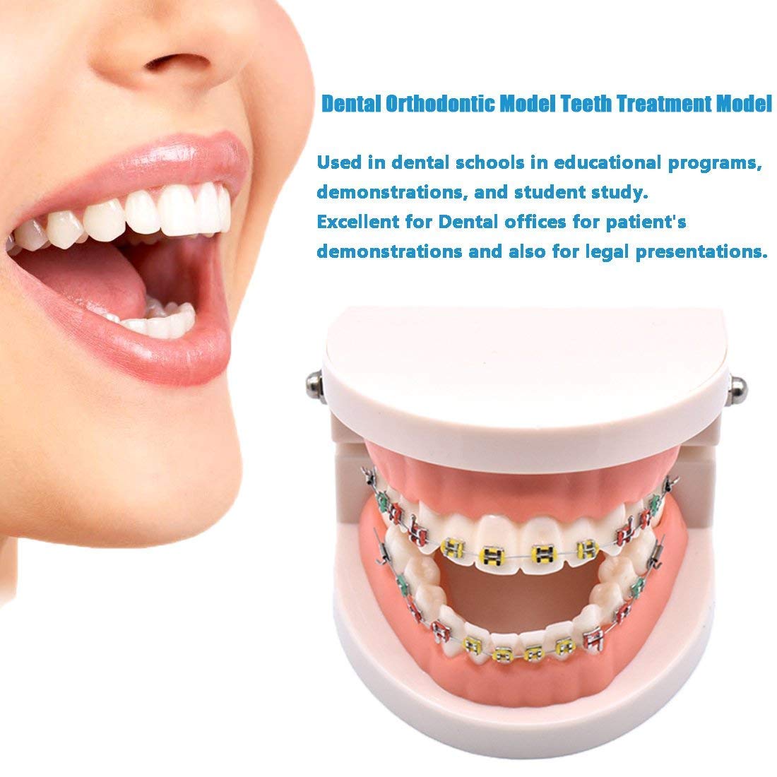 ERNZI Kieferorthopädische Zahnärztliche Behandlungsmodell Mit Keramischer Brackets, Kieferorthopädischer Metalldraht, Orale Kanalligatur, Verwendet Für Zahnärztliche Werkzeuge, Zahnärztliches Labor