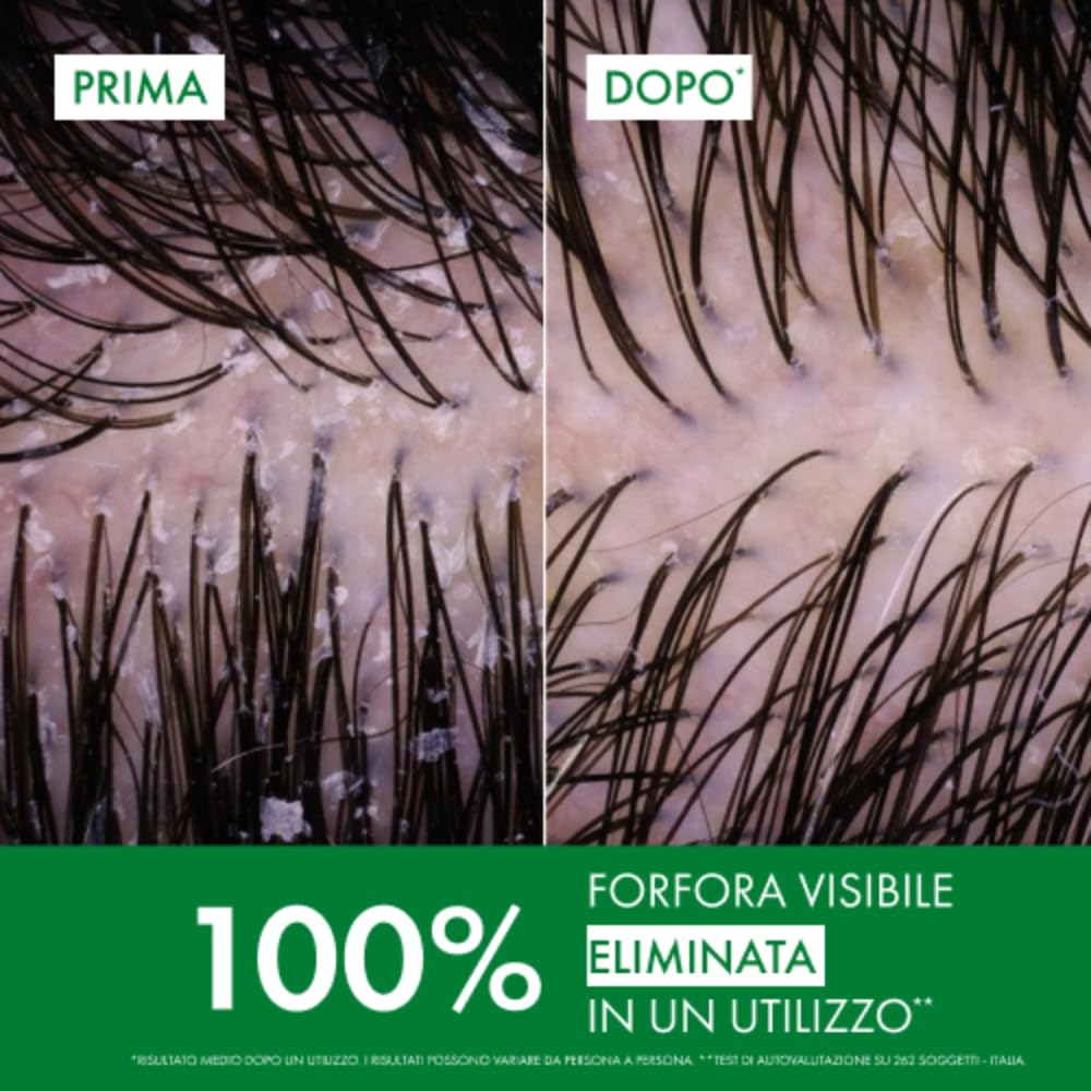 Vichy Dercos Eco-Ricarica Shampoo Anti-Forfora DS per Capelli Secchi, 390 ml