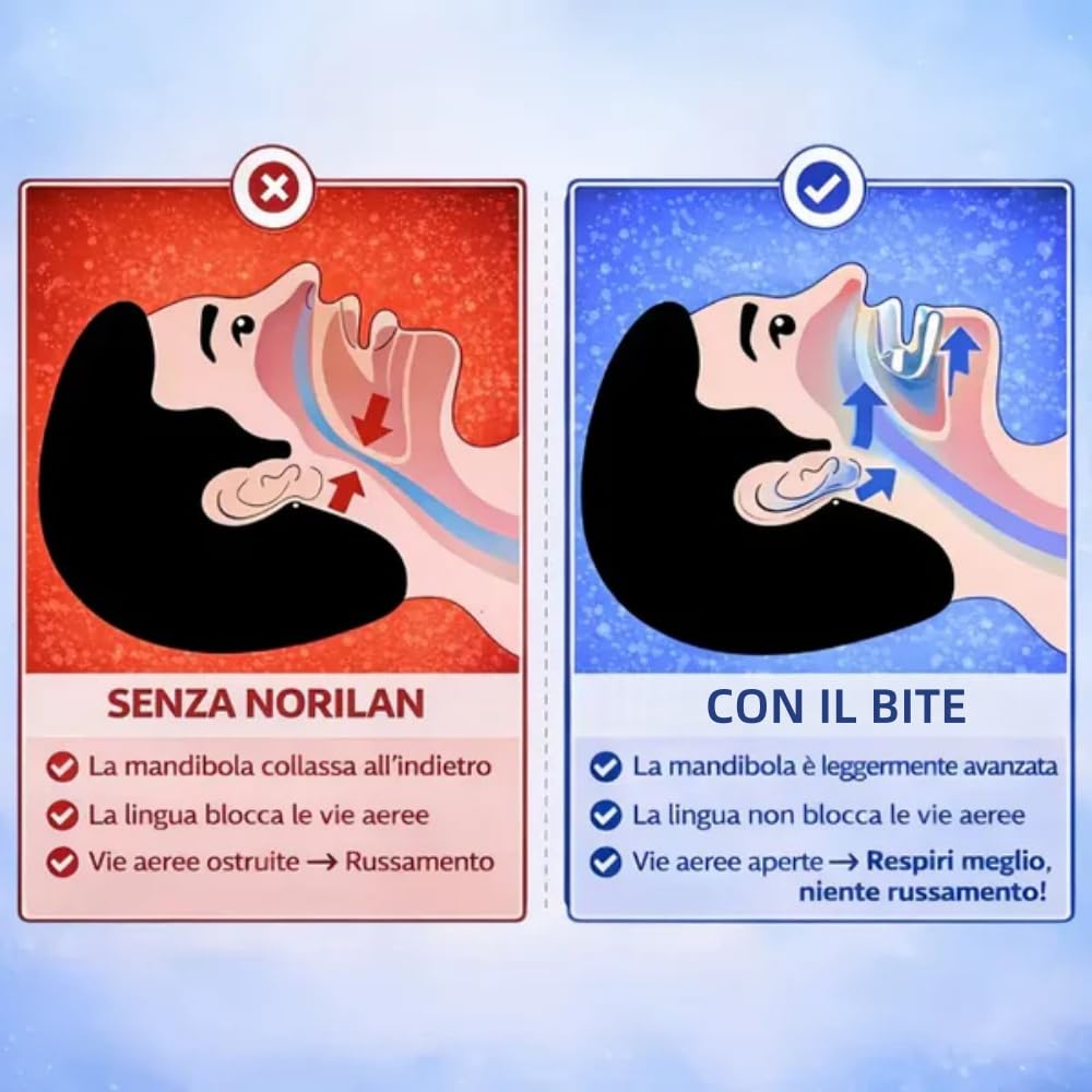 Norilan Plus Bite Anti-Russamento, Scatola di Stoccaggio, Reutilizzabili, Uomo e Donna, Migliora Qualità Sonno