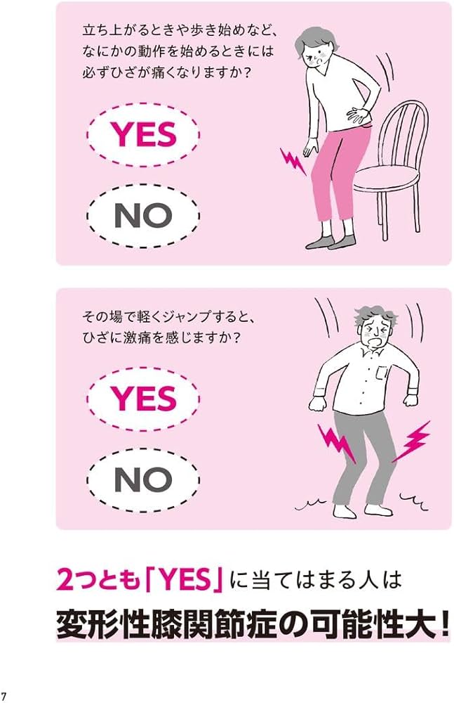 変形性膝関節症・股関節痛・むくみ　ダブルモーションテクニック〈下肢編〉 変形性膝関節症・股関節痛・むくみ ダブルモーションテクニック