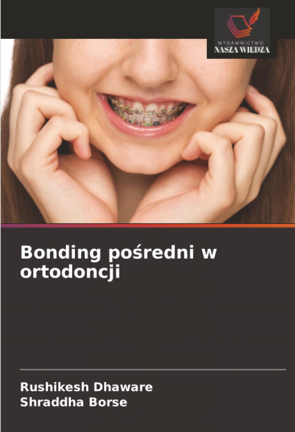 Bonding pośredni w ortodoncji