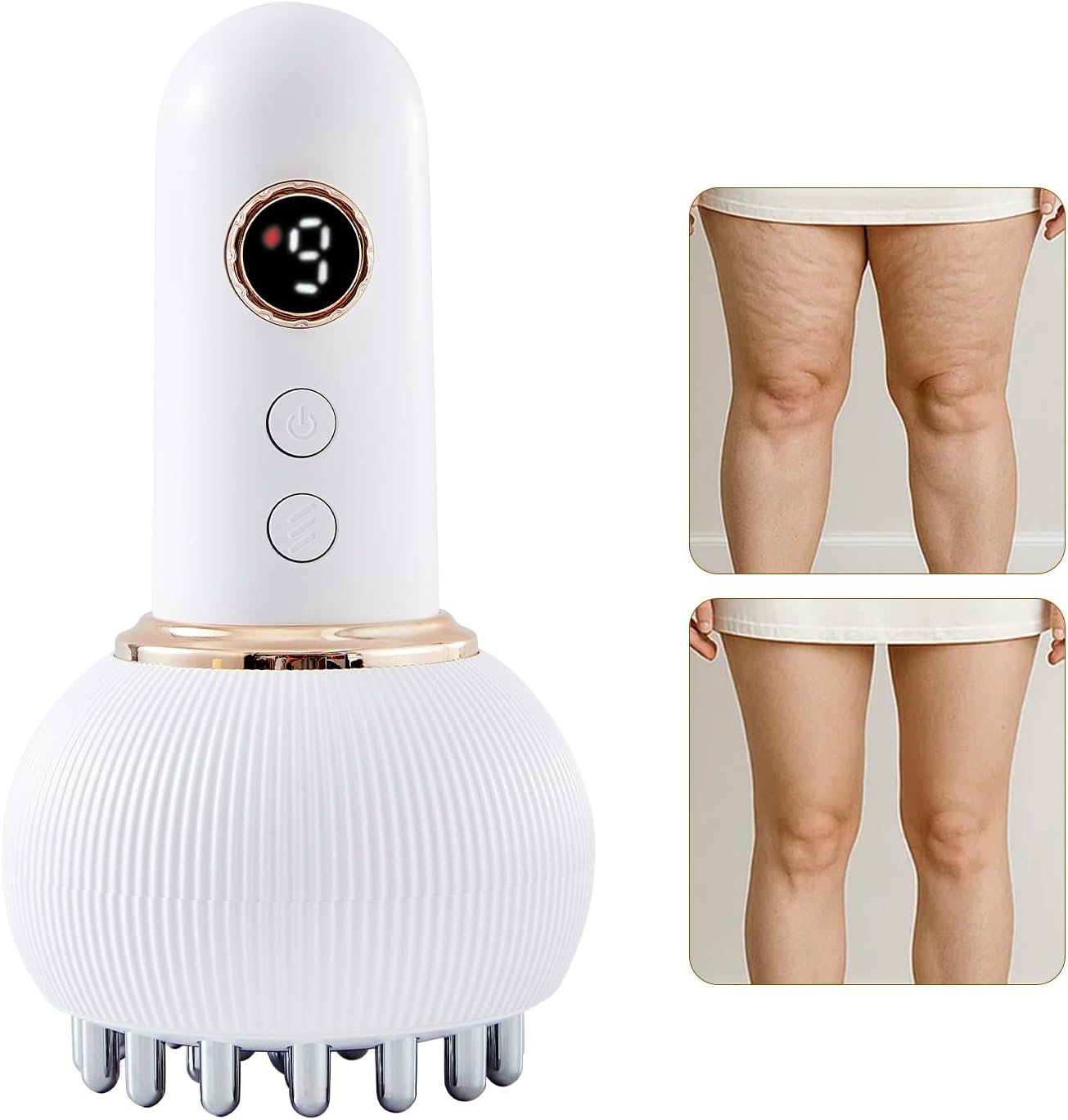 Lymphatic Drainage Massager & Anti Cellulite Massage Tool, Helps Reduce Stretch Marks & Cellulite, for Legs, Arms & Belly, Body Sculpting Machine with Microcurrent, Light, Heat & Vibration Lymphatic Drainage Massager & Anti Cellulite Massage Tool, Helps Reduce Stretch Marks & Cellulite, for Legs, Arms & Belly, Body Sculpting Machine with Microcurrent, Light, Heat & Vibration