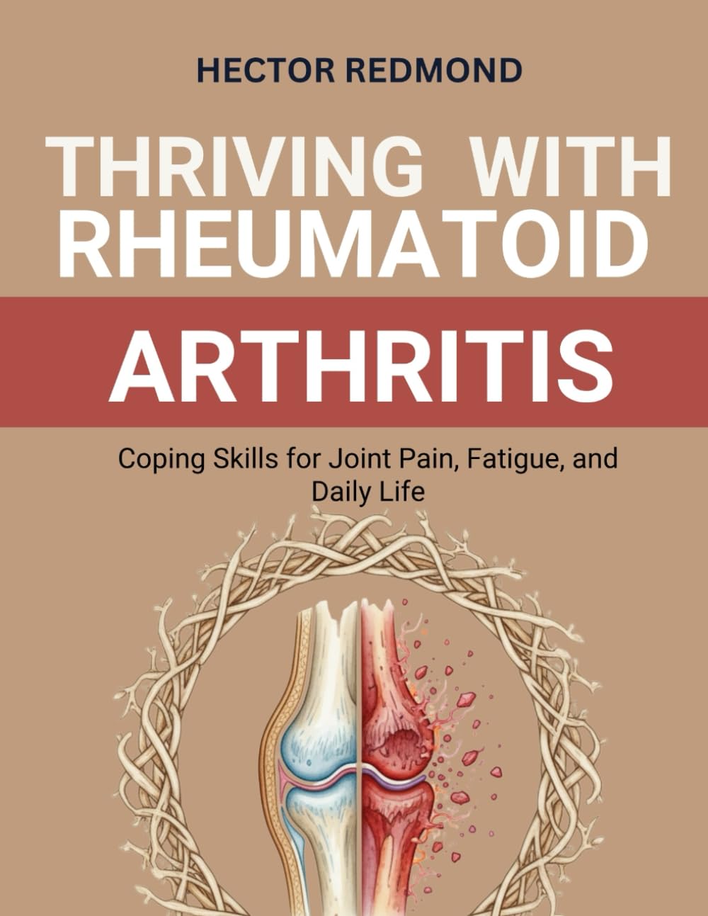 Thriving with Rheumatoid Arthritis: Coping Skills for Joint Pain, Fatigue, and Daily Life