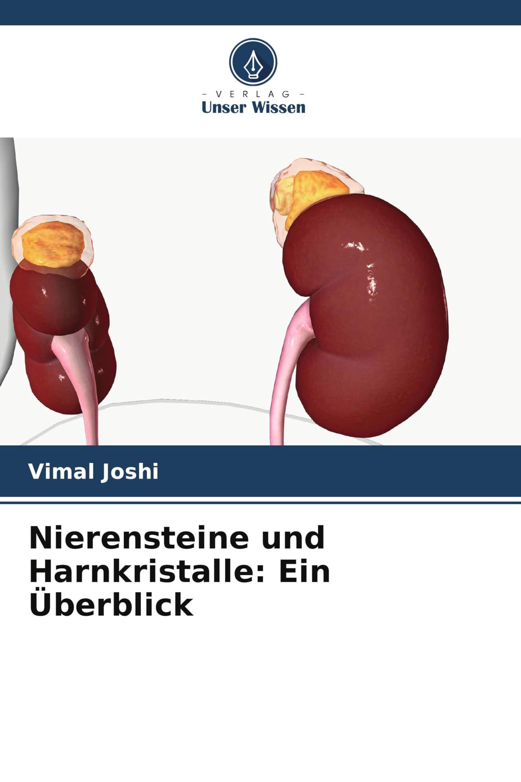 Nierensteine und Harnkristalle: Ein Überblick