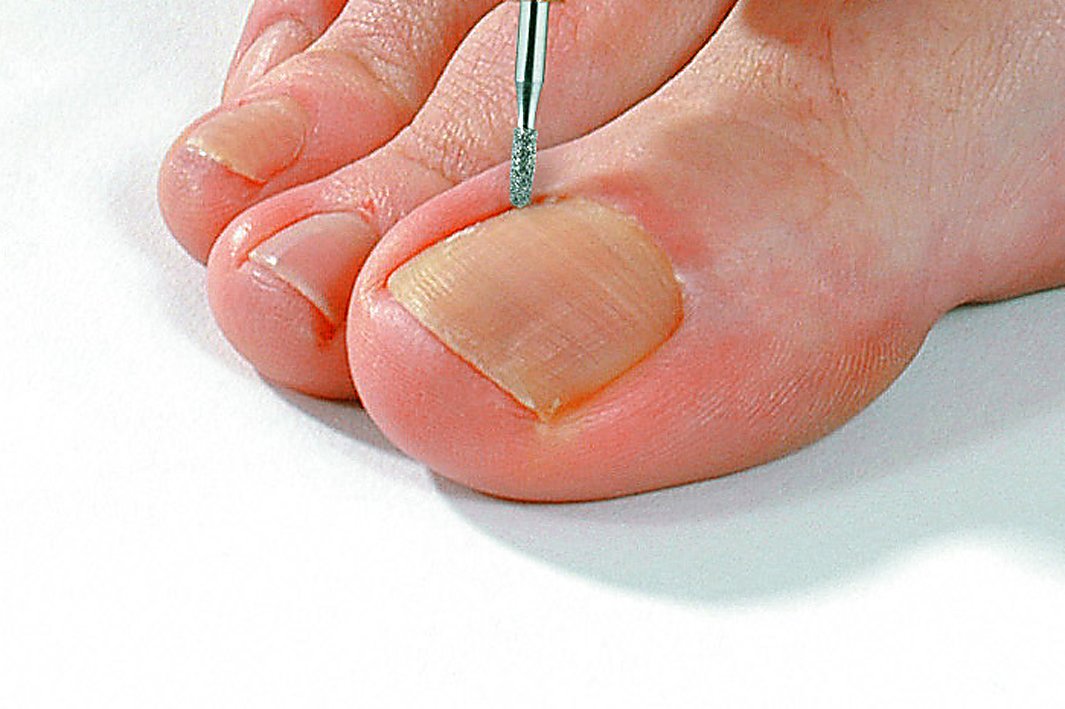 角質ケアマシーン Amazon.co.jp: プロ仕様 電動 角質ケア＆ネイルケアマシン フットプロ