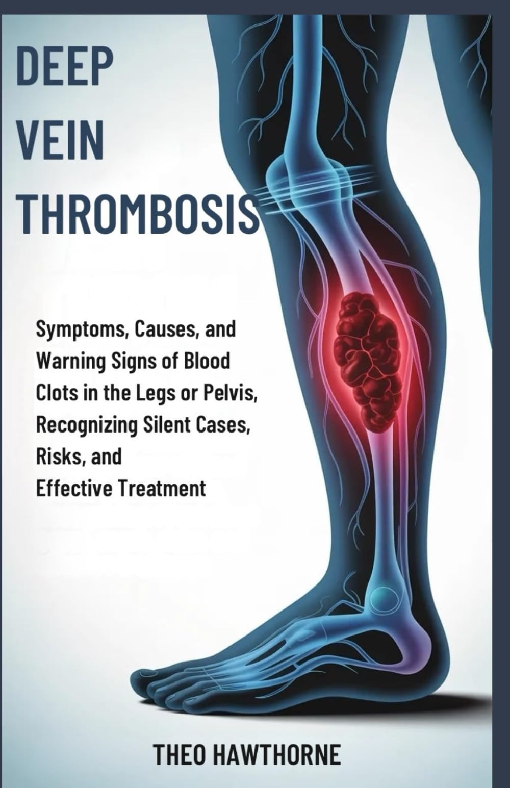 Deep Vein Thrombosis: Symptoms, Causes, and Warning Signs of Blood Clots in the Legs or Pelvis, Recognizing Silent Cases, Risks, and Effective Treatment