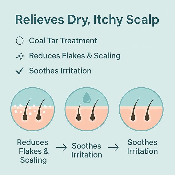 Coal Tar Scalp Shampoo 150ml Pack of 2 | Dry Itchy Scalp Treatment with Silicone Scalp Scrubber | Soothes Psoriasis, Dandruff & Seborrheic Dermatitis (2)