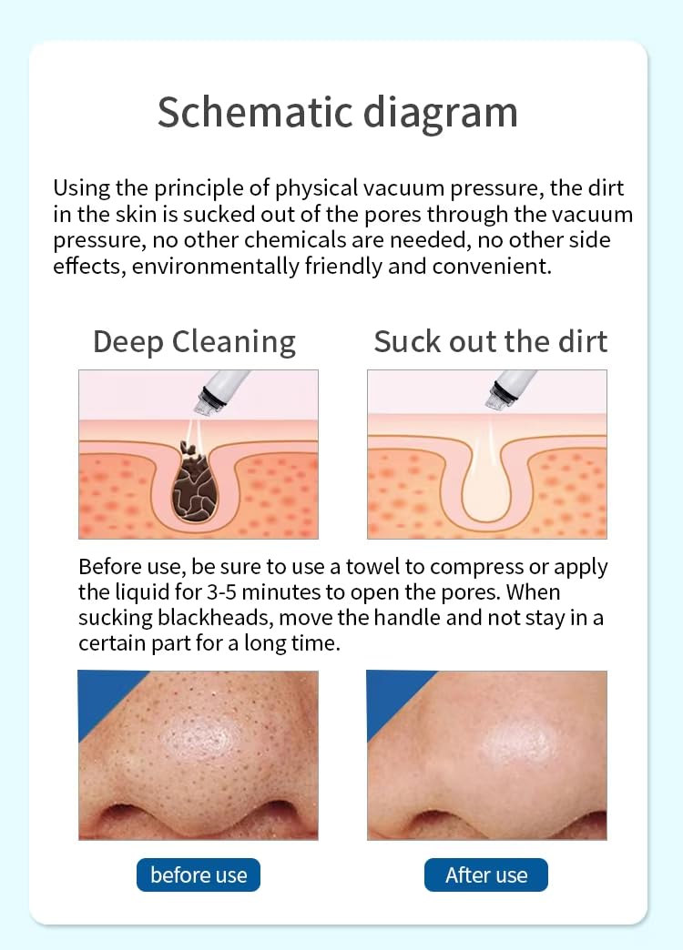 Hydra - Macchina facciale 7 in 1 con analizzatore della pelle, dispositivo di bellezza per idrodermoabrasione e idrodermoabrasione, per spa e salone