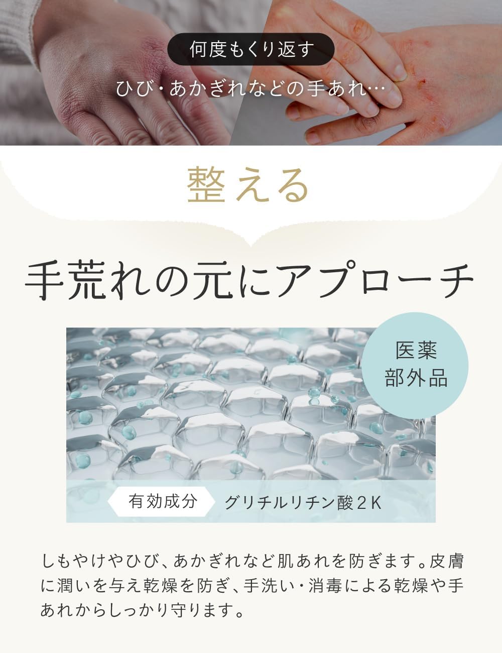 ILUS 薬用ハンドクリーム ひび あかぎれ 肌荒れ 医薬部外品 エイジングケア ギフト 50g (1)