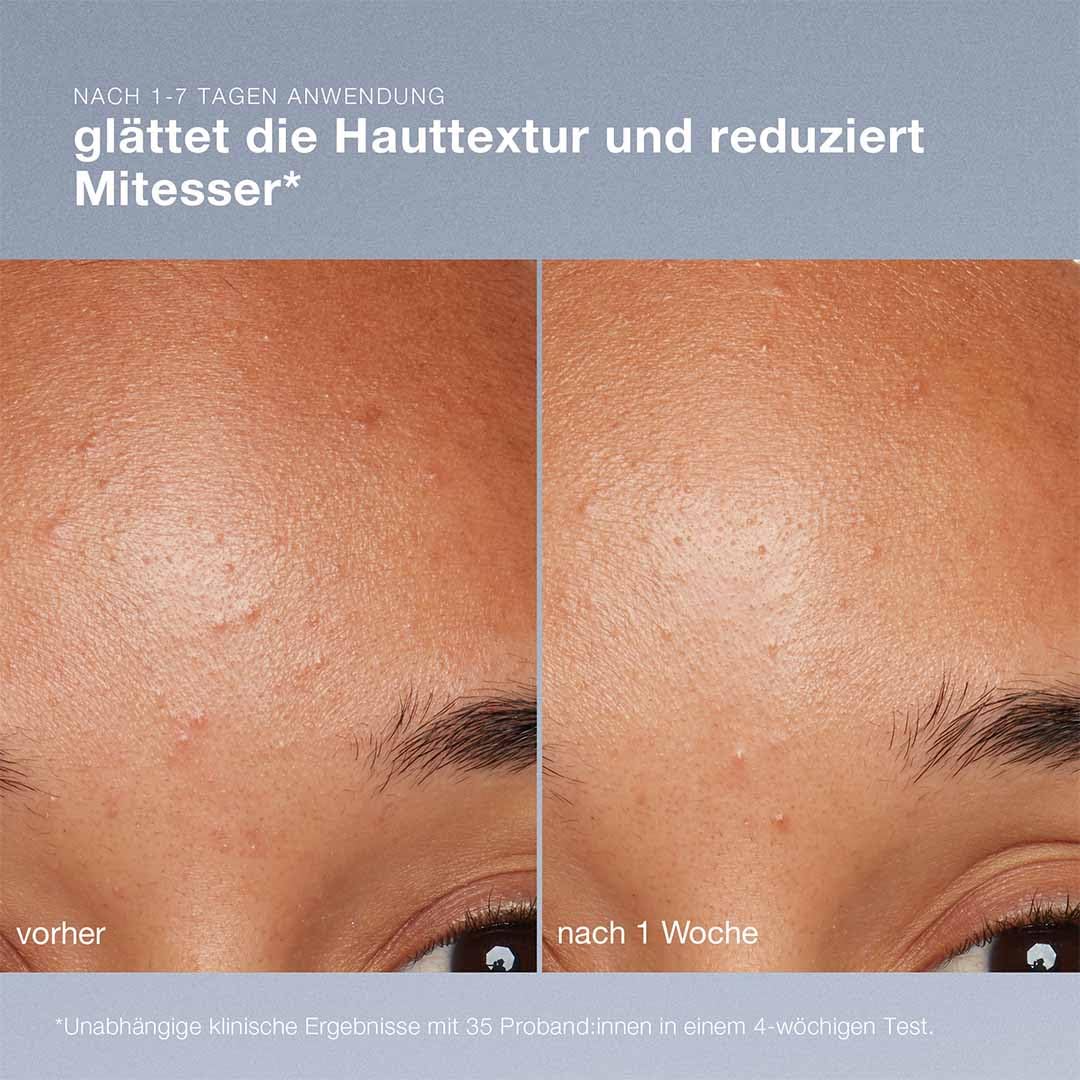 Dermalogica Daily Microfoliant Enzympeeling 74g | Reisbasiertes Enzympeeling mit Salicylsäure und Papain für glattere, strahlendere Haut.