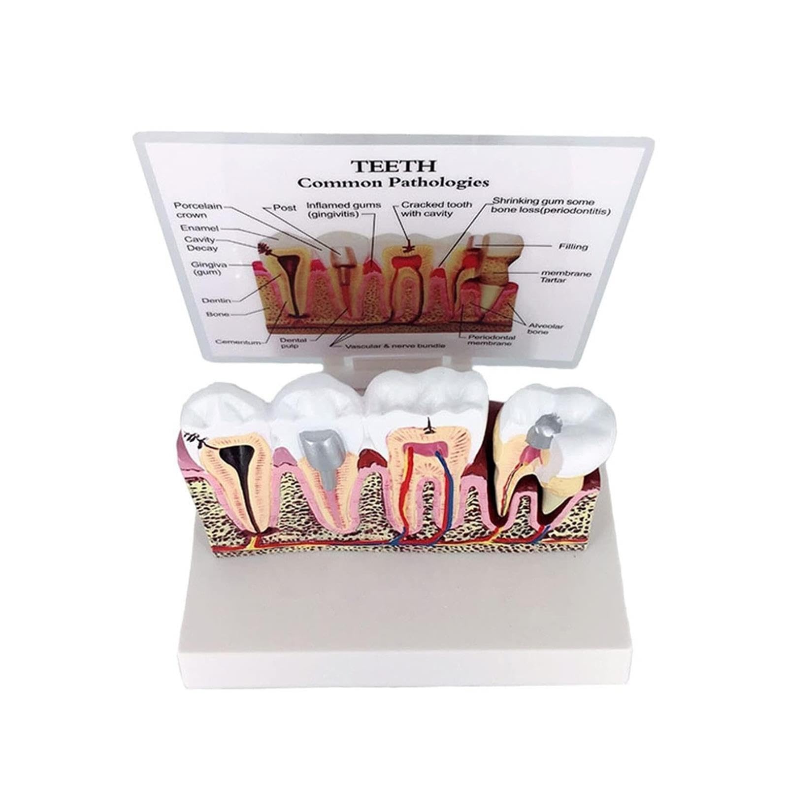 Anatomia dentale Educazione Modello Dente