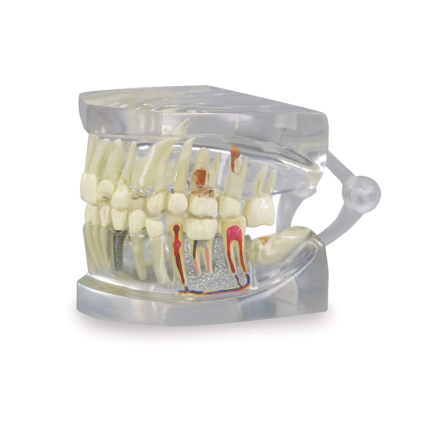 Modello anatomico dentale di mascella con denti per uso educativo, perfetto per studi dentisti e studenti di odontoiatria, replica anatomica del corpo umano