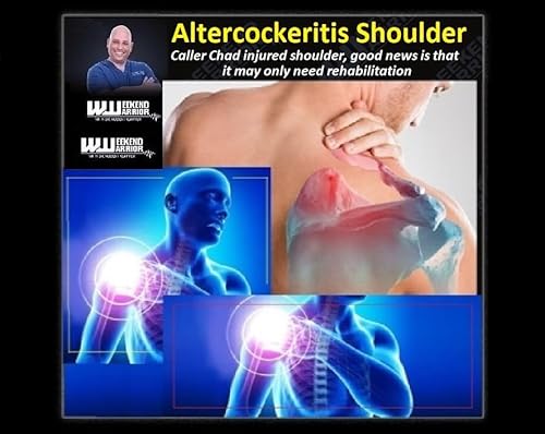 Page de couverture de Altercockeritis Shoulder