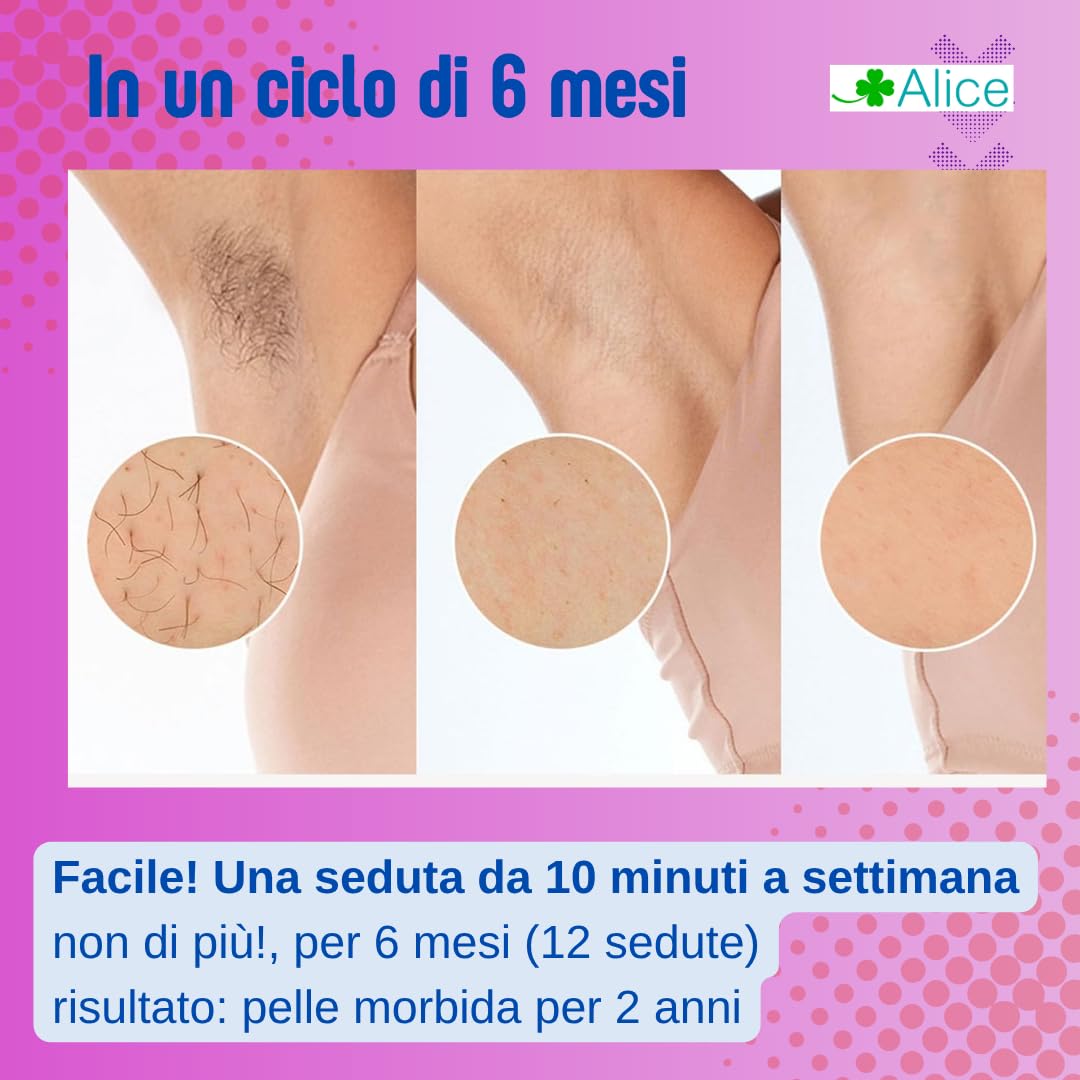 Alice. Epilatore luce pulsata, raffreddante, flash al quarzo, iper potente e indolore. Epilazione duratura, 2 anni, (ascella gambe maglia)