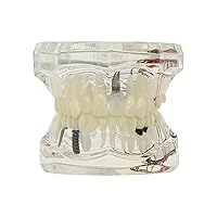 Vista 7 de Multifarious Tipos Modelo Dental Dientes Removibles Implante Ortodoncia Enseñanza Estudiar Modelos de demostración para Dentista Estudiante Escuela