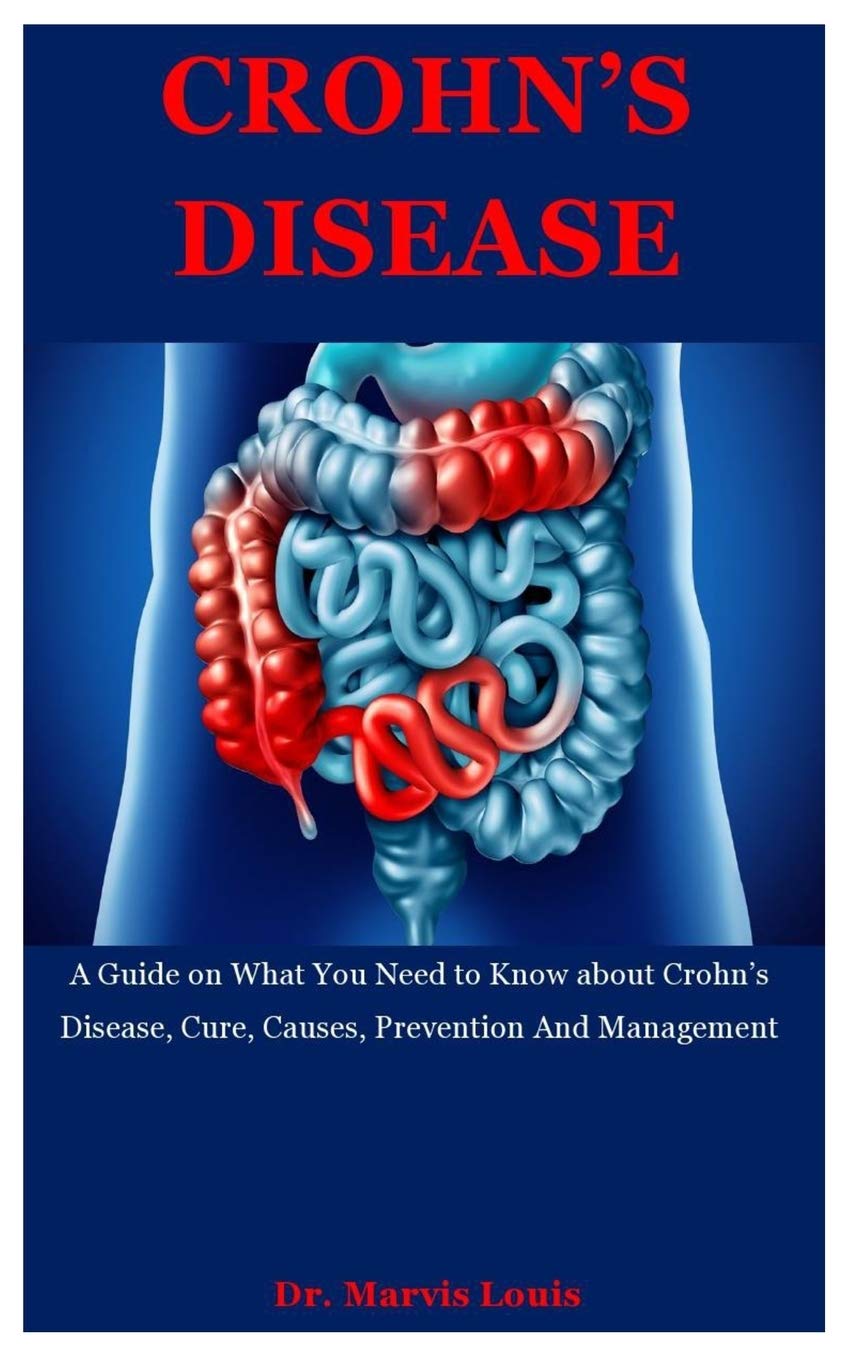 Buy Crohn's Disease A Guide on What You Need to Know about Crohn's