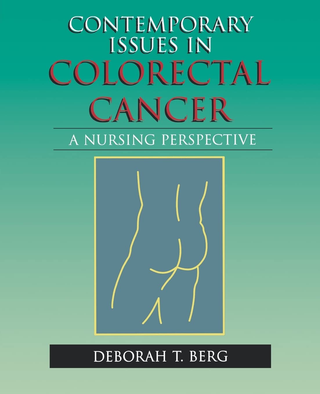 Contemporary Issues in Colorectal Cancer (Jones & Bartlett Series in Oncology)