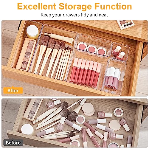 Image of SMARTAKE 22-Piece Drawer Organizer with Non-Slip Silicone Pads, 5-Size Clear Desk Drawer Organizer Trays Storage Tray for Makeup, Jewelries, Utensils in Bedroom Dresser, Office and Kitchen, Clear