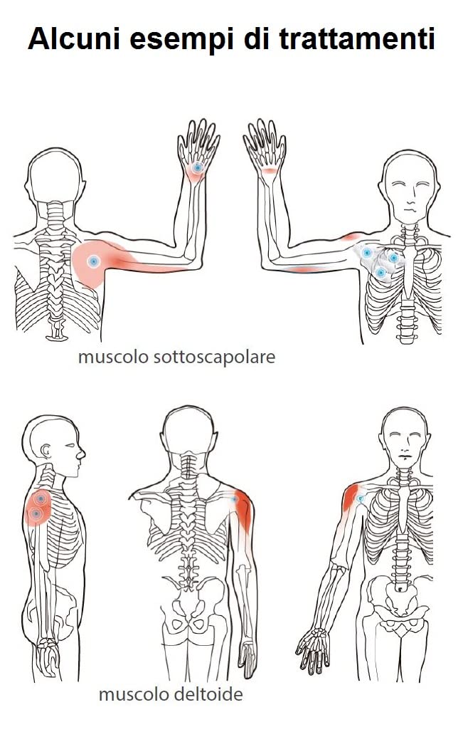 Ultrasuoni portatile terapie antidolorifiche massaggi con ultrasuonoterapia per il benessere di tutto il corpo con gel Arnica