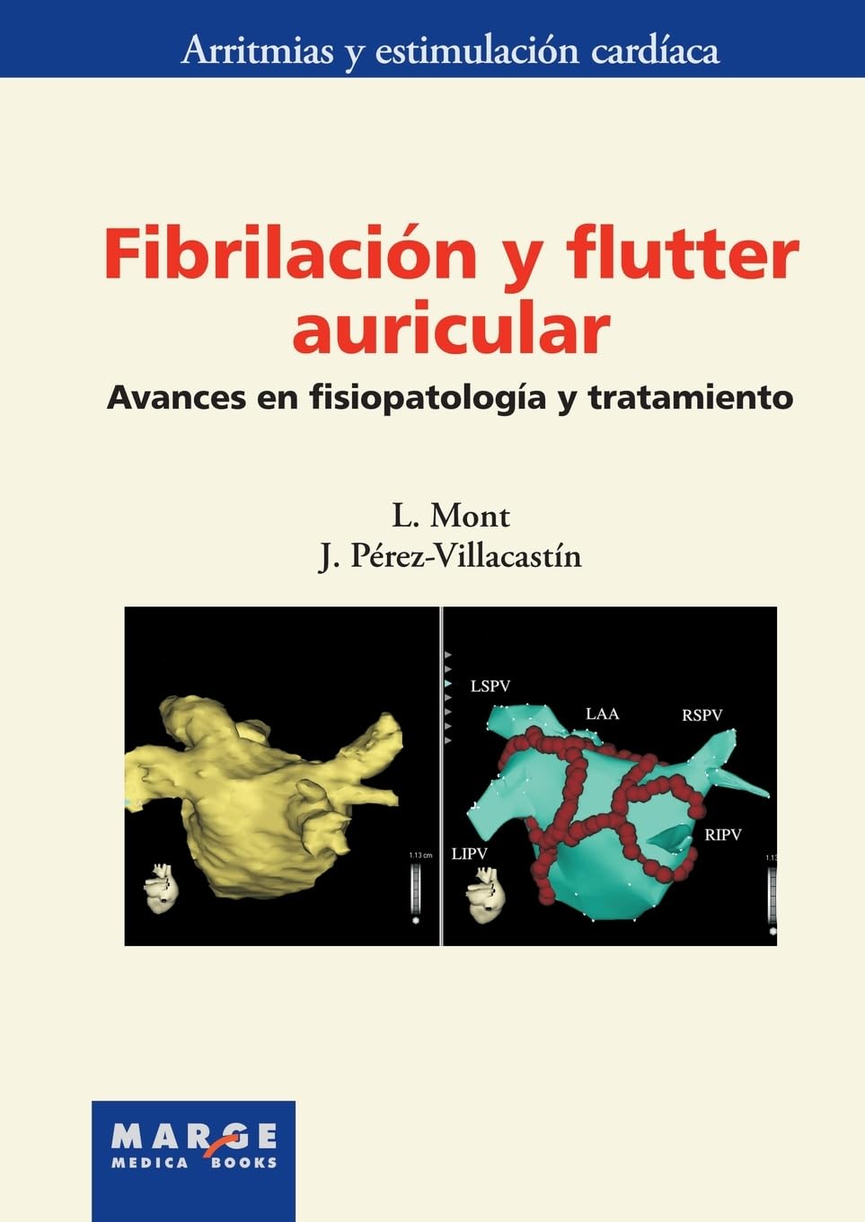 Fibrilación y flutter auricular: Avances en fisiopatología y tratamiento