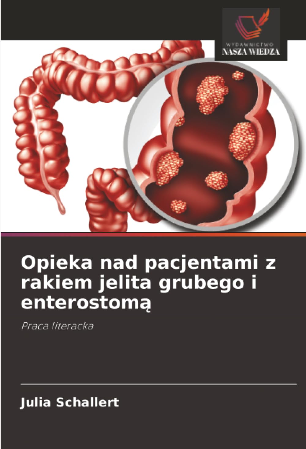 Opieka nad pacjentami z rakiem jelita grubego i enterostomą: Praca literacka