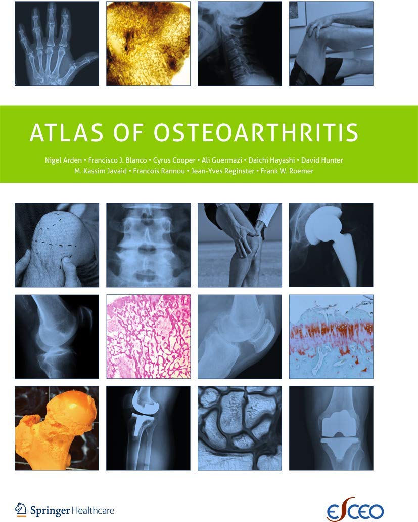 Buy Atlas of Osteoarthritis — BookShops.in