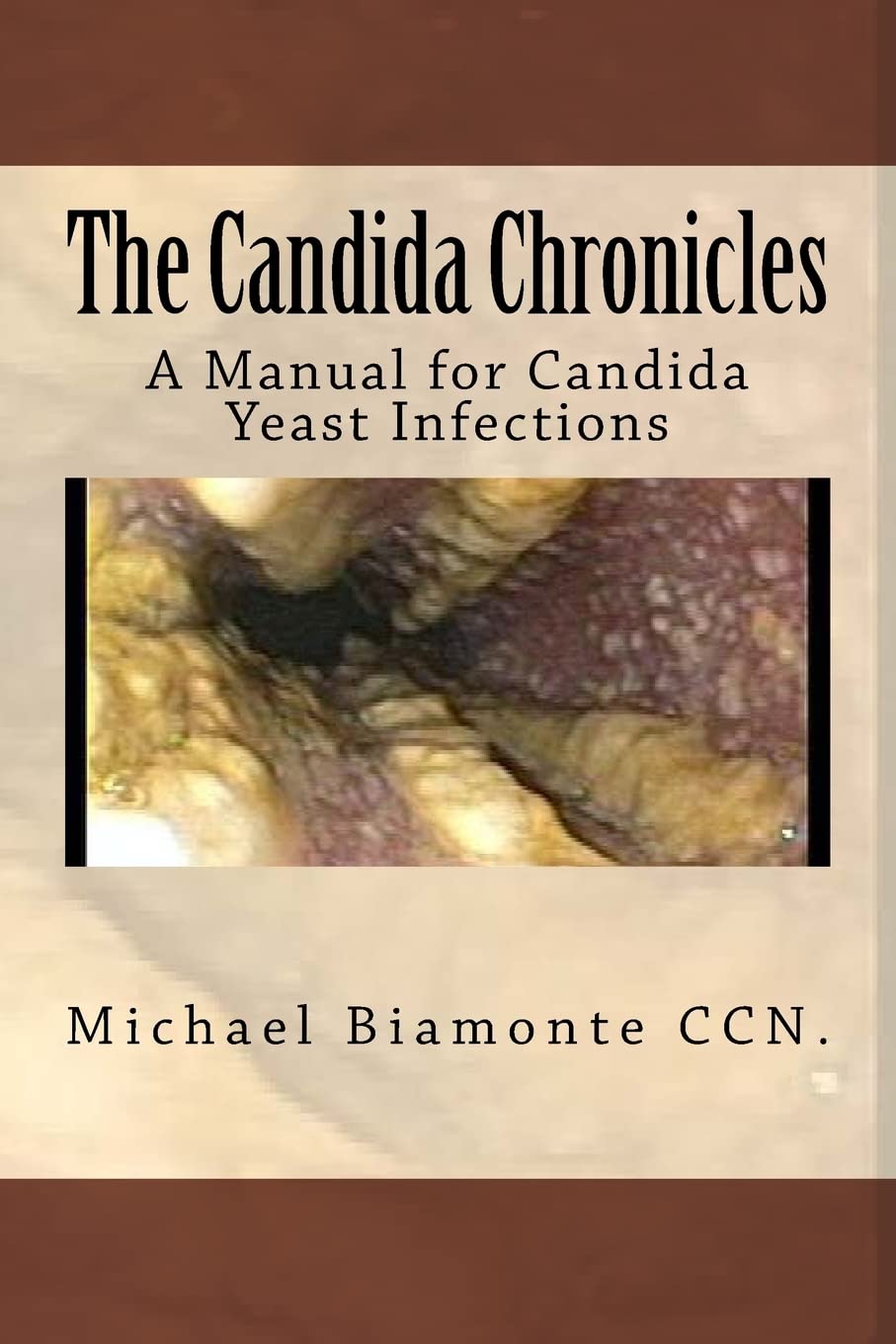 The Candida Chronicles: A Manual for Candida Yeast infections: A Mannual for Candida/Yeast Infections: Volume 1