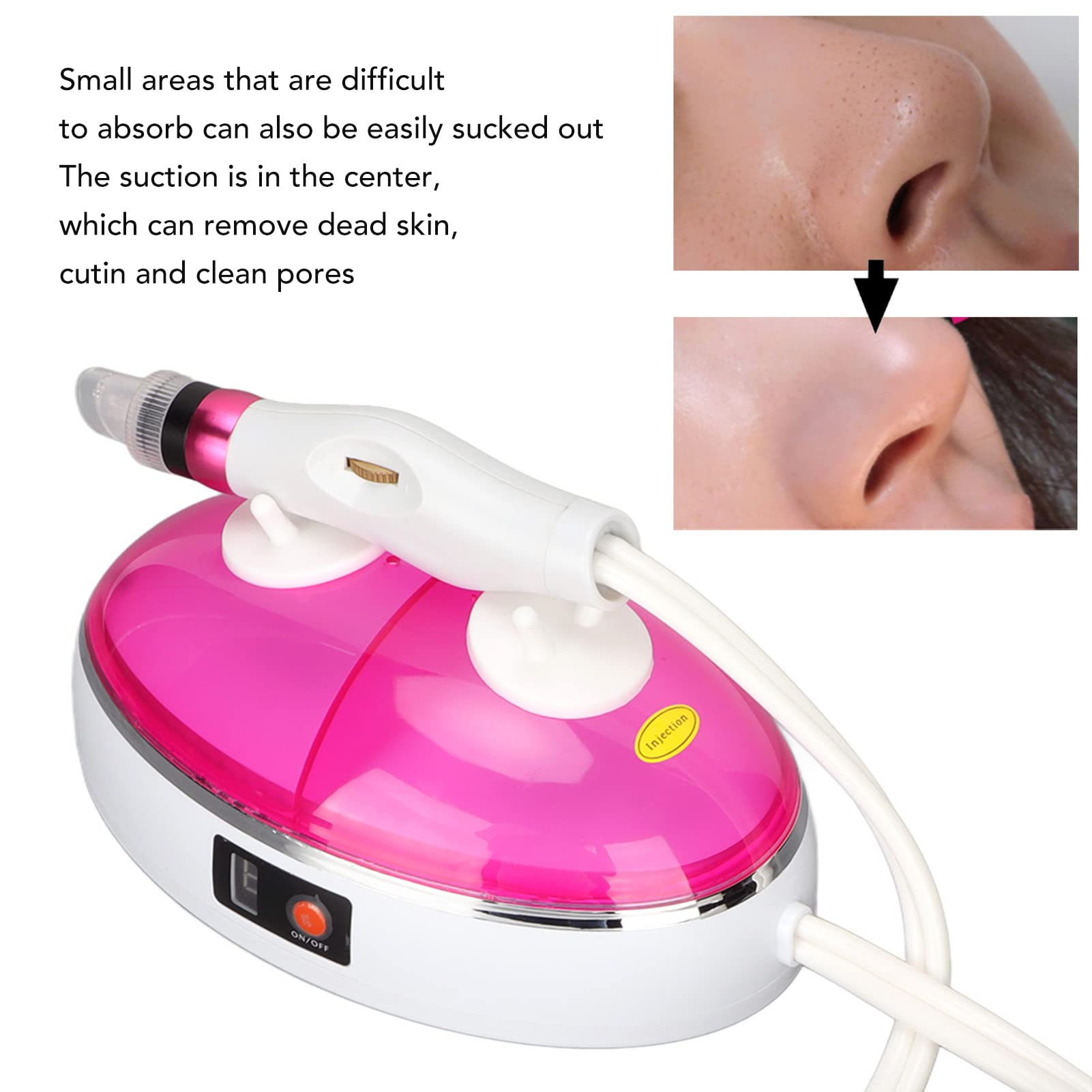 Estrattore di Punti Neri per Pori del Naso - Pulitore per Pori con 3 Modalità di Regolazione, Mini Design e Kit di Strumenti per Estetisti, Rimuove Brufoli e Imperfezioni della Pelle