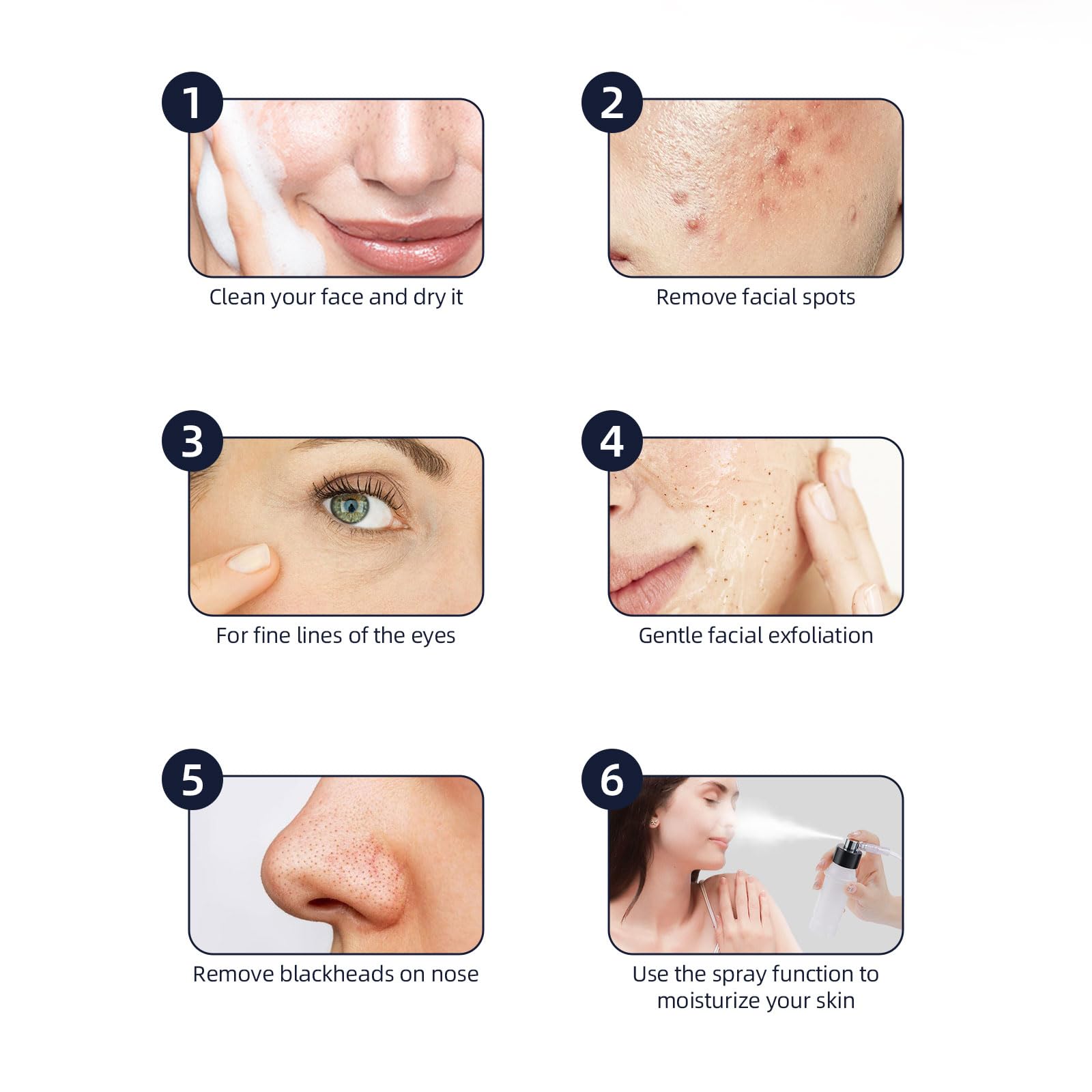 Máquina de microdermoabrasión de diamante, 3 en 1, máquina profesional de dermoabrasión de microdermoabrasión para eliminación de puntos negros, kit de dermoabrasión para el cuidado de la piel 5