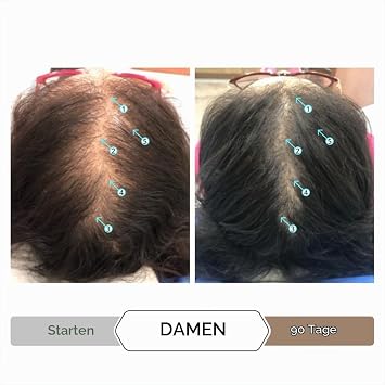 DS Labs Spectral.DNC-N and Spectral.F7 Hair Thickening Serum Set Hair Thickening Volume and Healthier Looking Hair Non-Greasy for Men and Women (60 ml)