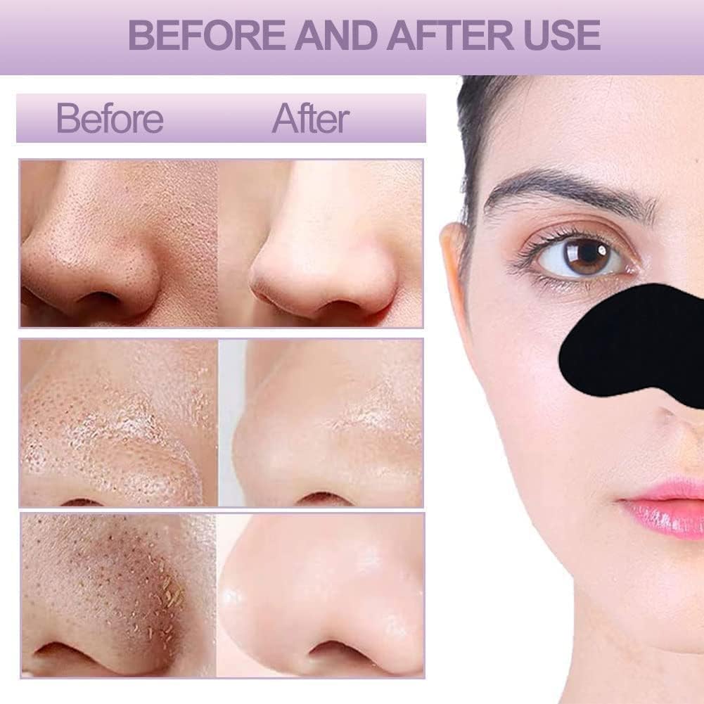 Trendy Styler Nose Strips, Blackhead Remover Remover & Pore Cleanser Skincare Cleansing Charcoal Patch Peel Off Nose Sticker for Women and man (PACK OF 5)