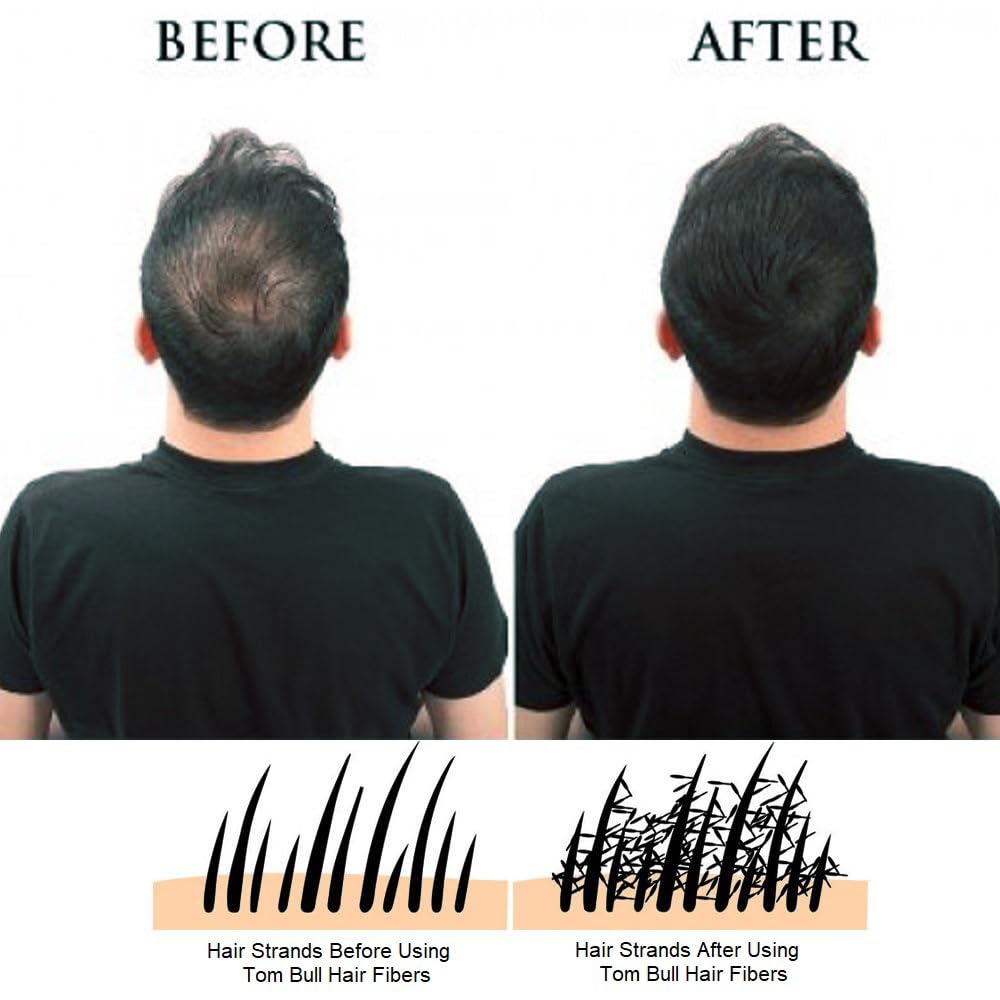 Tom Bull Hair Building Fibers Refill Pack for Caboki, Toppik etc. (BLACK) 50g, Hair Fiber for Thinning Hair & Bald spots – Hair Loss Concealer – Hair Thickening Fibers for Men & Women by TomBull 1