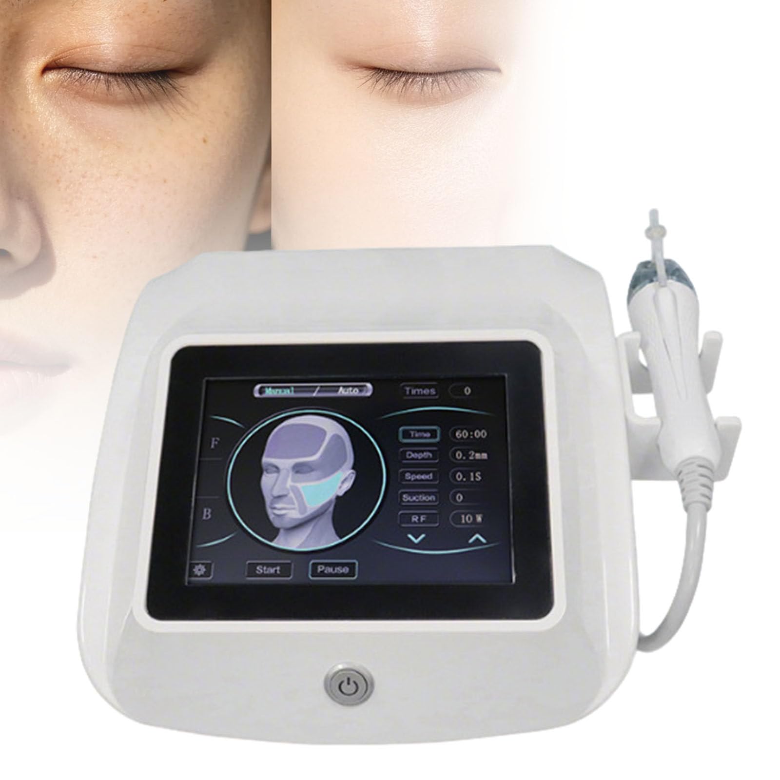 Ymnogjie Multicolor Fractional Rf Microneedling Machine For Facial Rejuvenation,Professional Device For Wrinkle Removal,Stretch Mark Treatment,Skin Lifting Therapy Skin Rejuvenation Beauty Machine