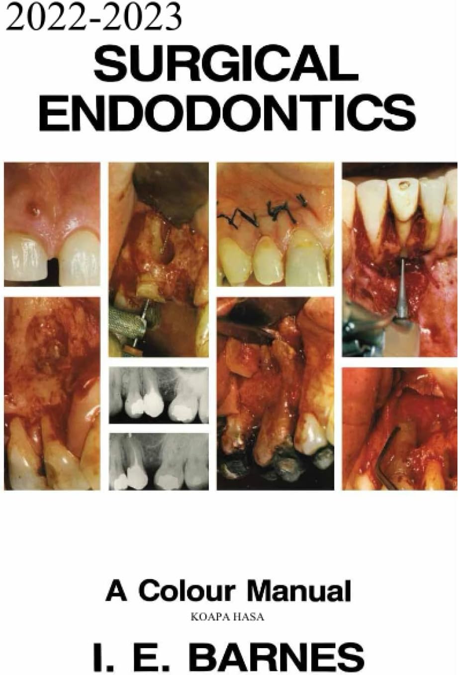 2022-2023 Surgical Endodontics