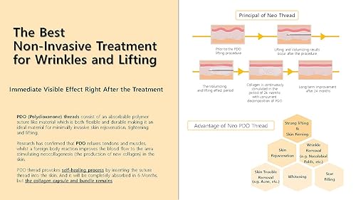 Miniatura 5 de NeoGenesis PDO - Roscas mono para elevación facial y corporal, 20 unidades (31G X 0.472 in) (M3112)