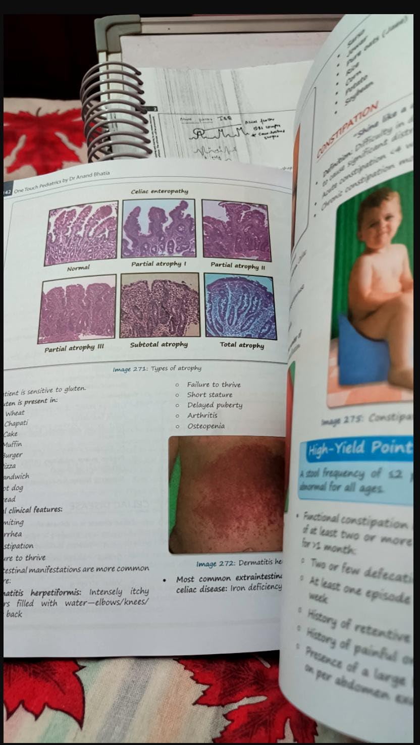 Buy One Touch Pediatrics For Neet Upsc Next Fmge Nin-Cet 2Ed (Pb 2025 ...