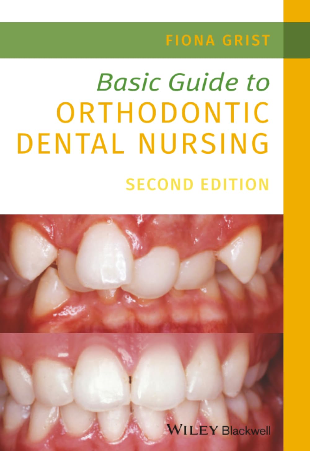 Basic Guide to Orthodontic Dental Nursing