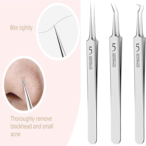 Miniatura 2 de Juego de herramientas de eliminación de espinillas y acné, 3 pinzas profesionales de acero inoxidable, extractor para eliminar espinillas y acné en