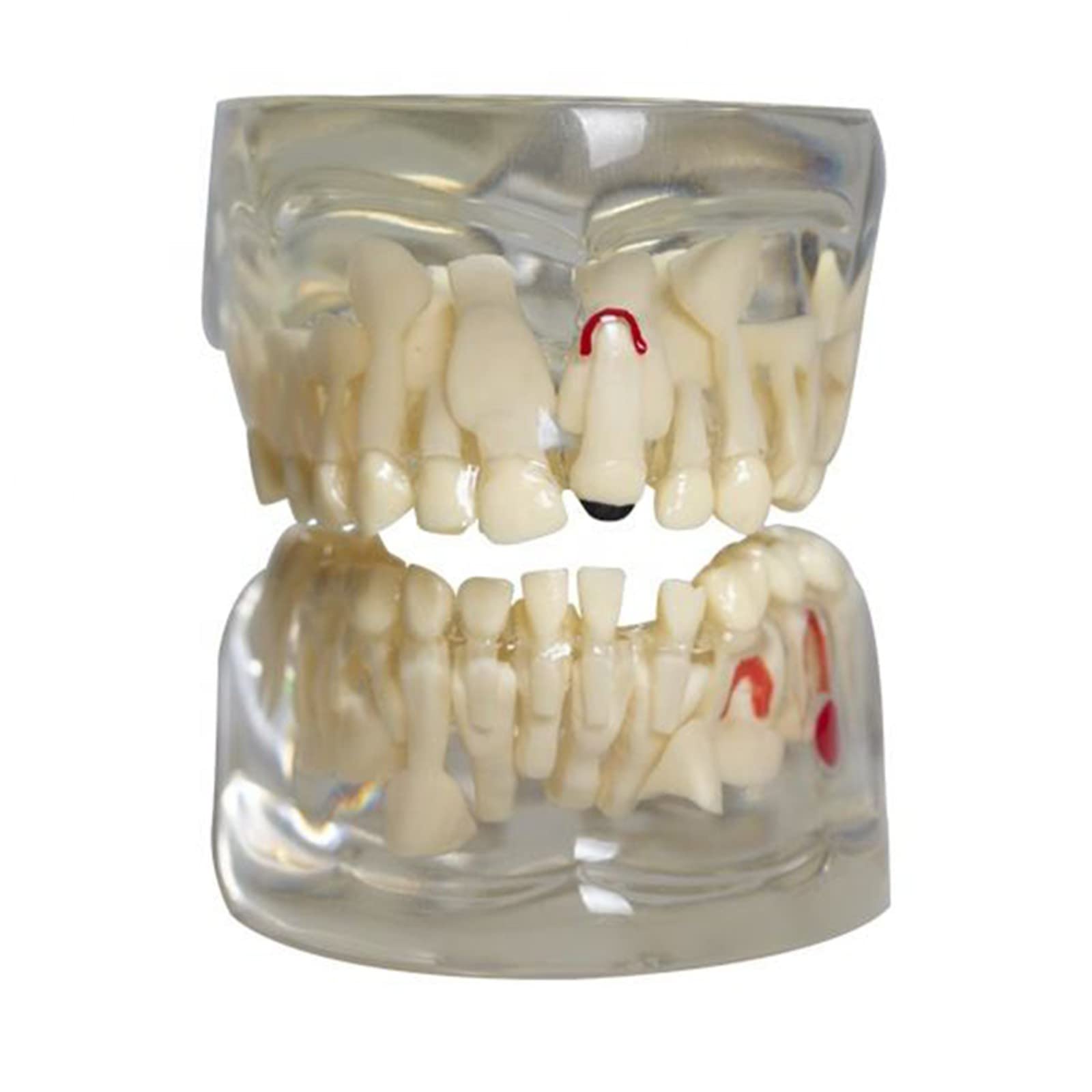 Transparentes Kinderzahnmodell – Dental-Modell De Produktbild-Vorschau 3