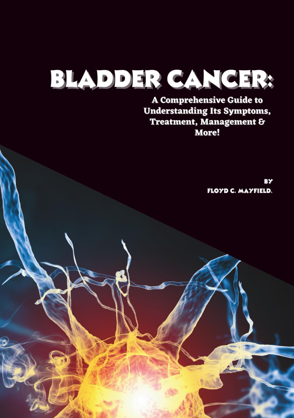 Bladder Cancer: A Comprehensive Guide to Understanding Its Symptoms, Treatment, Management & More! (Cancer Decoded)