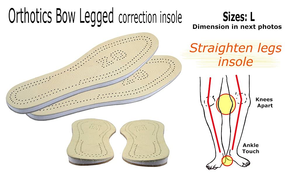 USFOOT® Orthotics Bow Leg Insole (Genu varum), Bow Leg Corrector, Knock