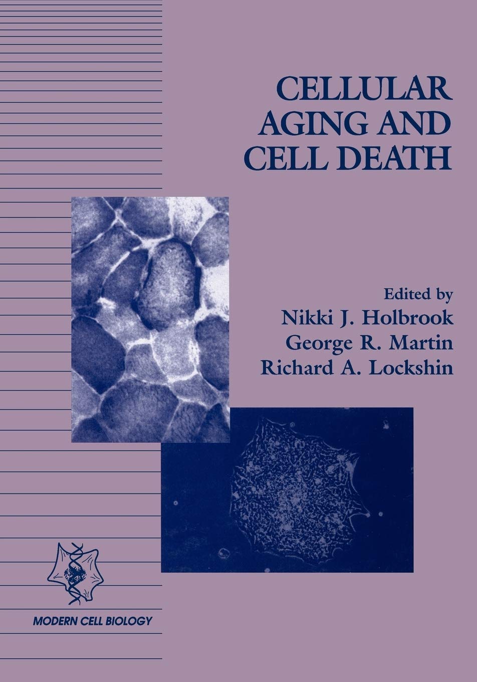 Cellular Aging and Cell Death