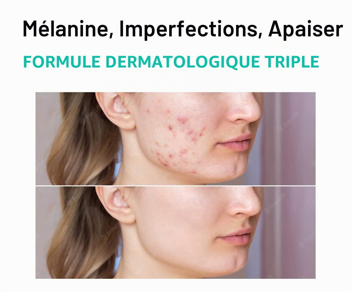 Melasma Traitement pour crème du visage - Élimination des taches sombres Centella Asiatica - Produits de beauté coréen de soins de la peau 40 ml