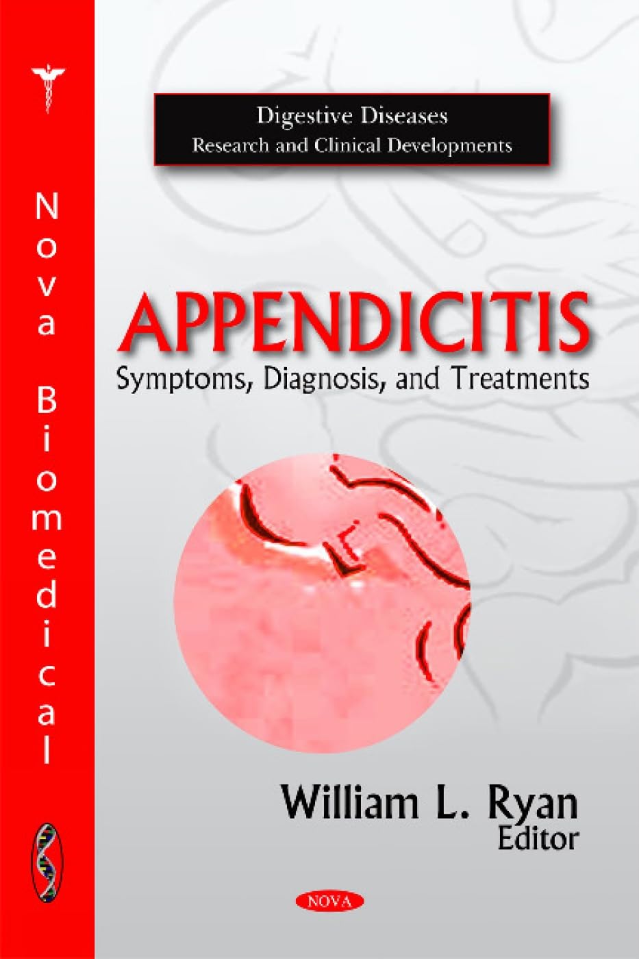 Buy Appendicitis: Symptoms, Diagnosis, and Treatments (Digestive Diseases Research and Clinical Developments) — BookShops.in