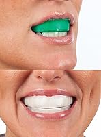 Vista 6 de Opalescenc 4648-1 - Bandejas blanqueadoras de dientes prellenadas – Original 15% – (4 tratamientos) – Peróxido de hidrógeno con PF – Cool Mint
