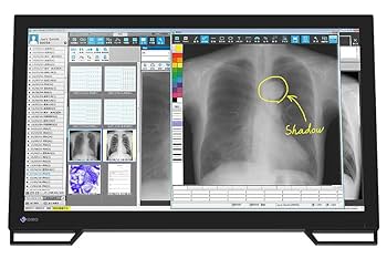 Amazon.co.jp: EIZO 10点マルチタッチ対応 23型電子カルテ画像