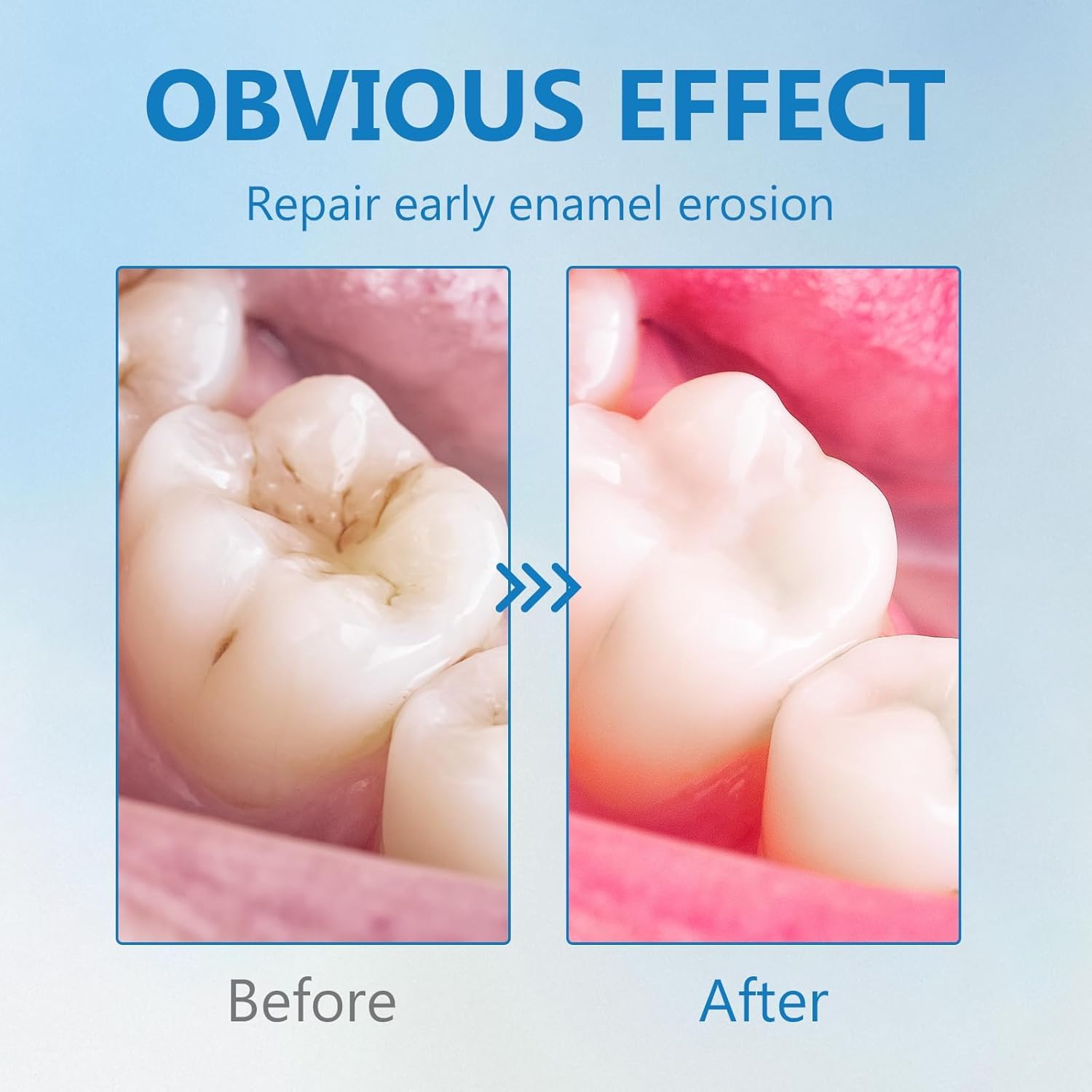 Cavity Healing Tooth Armor Liquid - Advanced Enamel Repair & Nano Hydroxyapatite Remineralization Drops for Sensitive Teeth - Supports Gum Health & Cavity Reversal — view 8