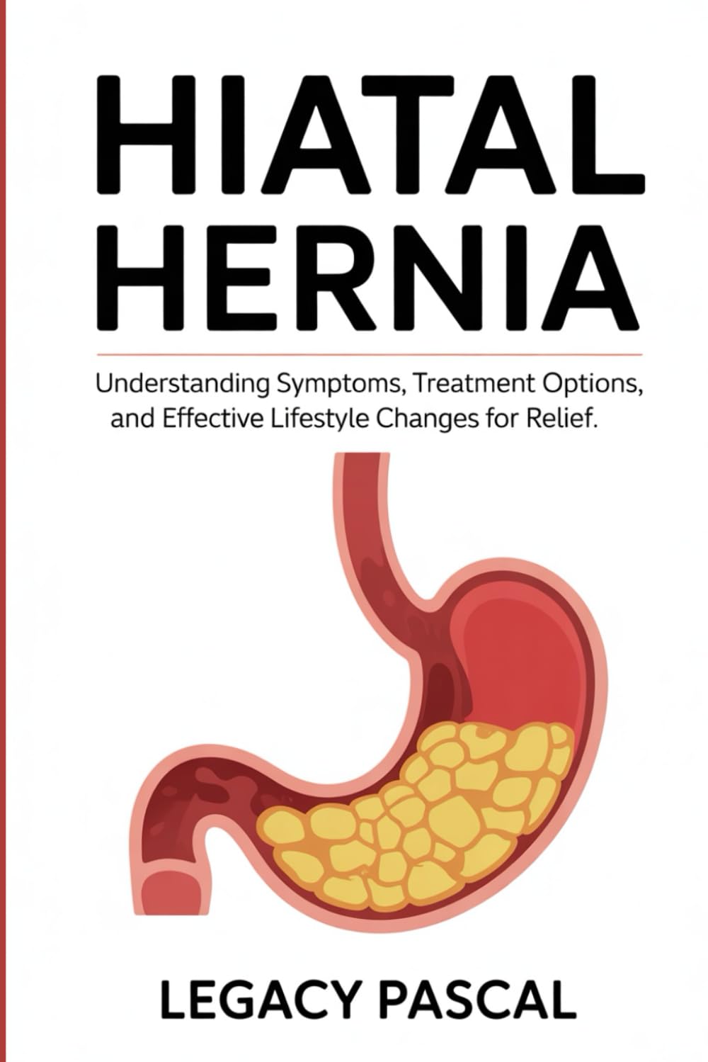 Hiatal Hernia: Understanding Symptoms, Treatment Options, and Effective Lifestyle Changes for Relief.