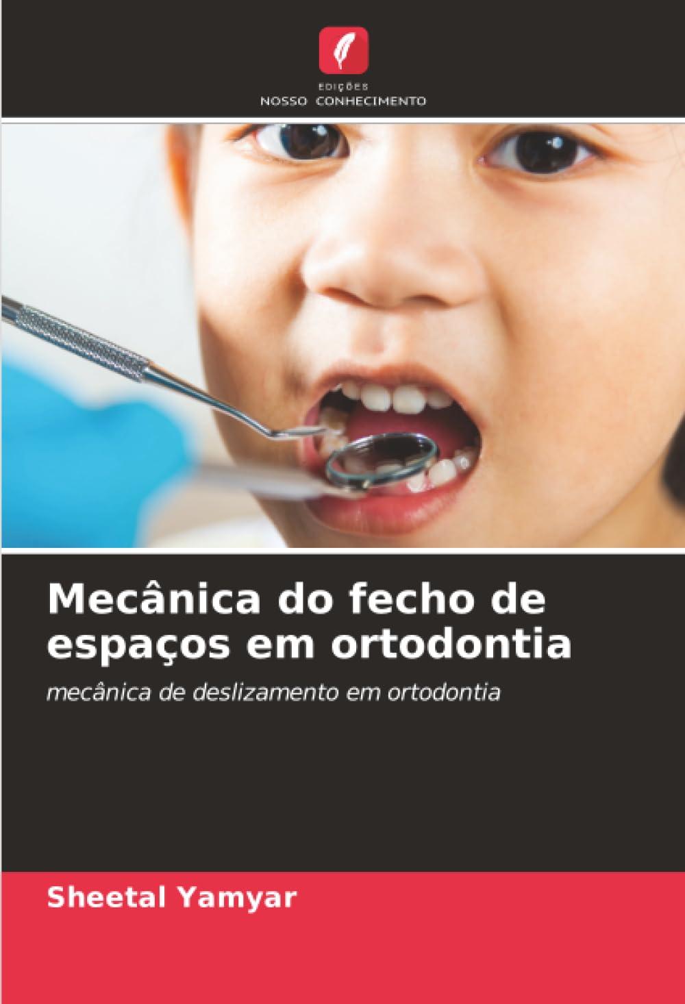 Mecânica do fecho de espaços em ortodontia: mecânica de deslizamento em ortodontia